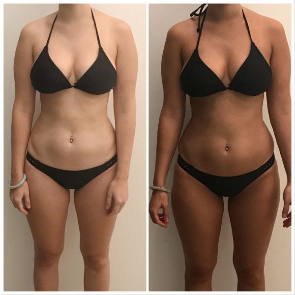 Prima e dopo — risultato abbronzatura uniforme