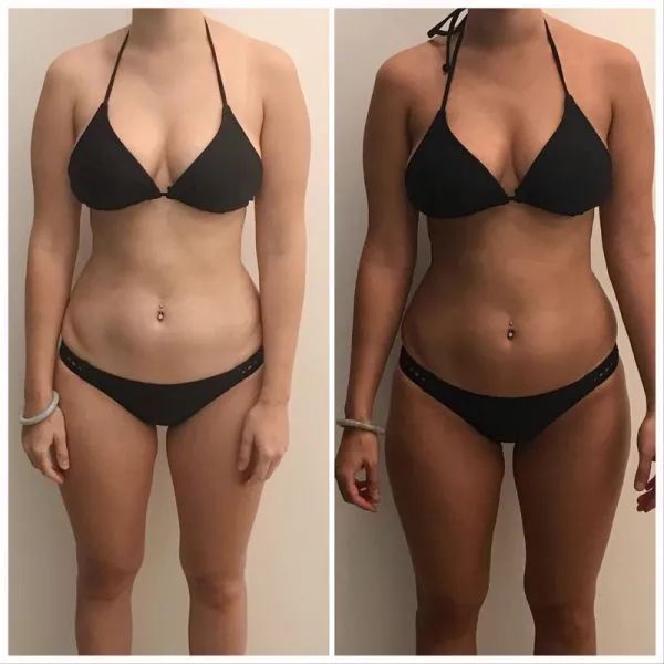 Prima e dopo — risultato abbronzatura uniforme