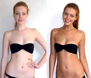 Prima e dopo — pelle chiara trasformata con abbronzatura dorata