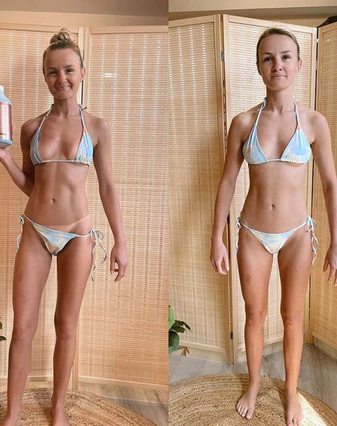 Risultato dopo 2 applicazioni di gel autoabbronzante