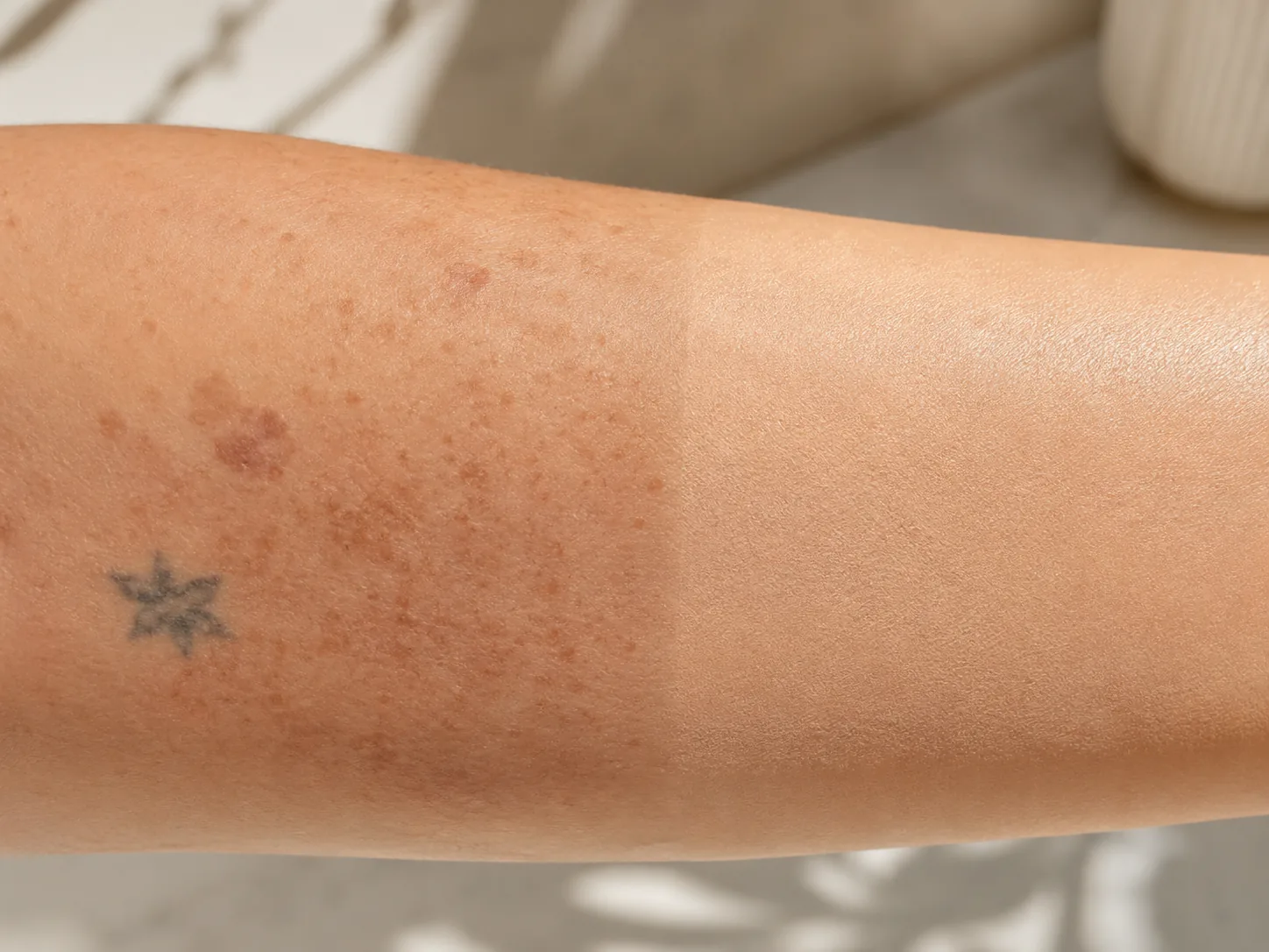 Invisible Tattoo - pigmentata al 50%, copertura altissima