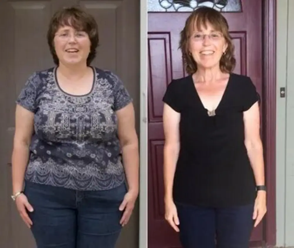 Prima e dopo MatchaSlim — donna over 50