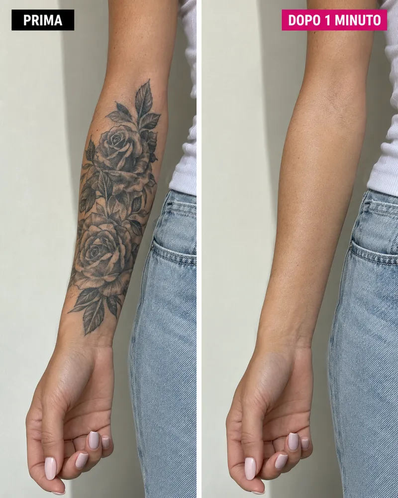 Prima e dopo: tatuaggio sull'avambraccio coperto con Invisible Tattoo