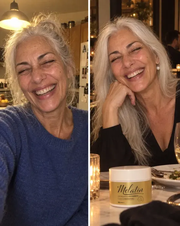 Lucia prima e dopo due mesi di Melatin