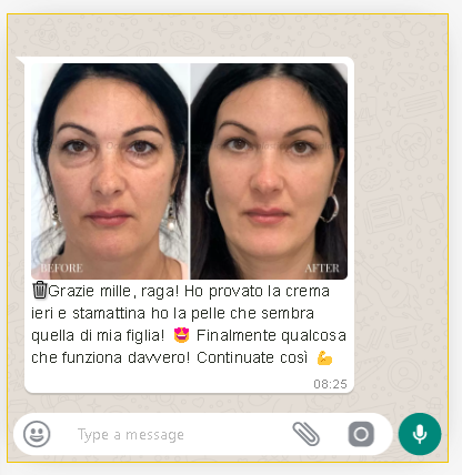 Rivela la Tua Pelle Radiosa con Vèlo - Gold Skin