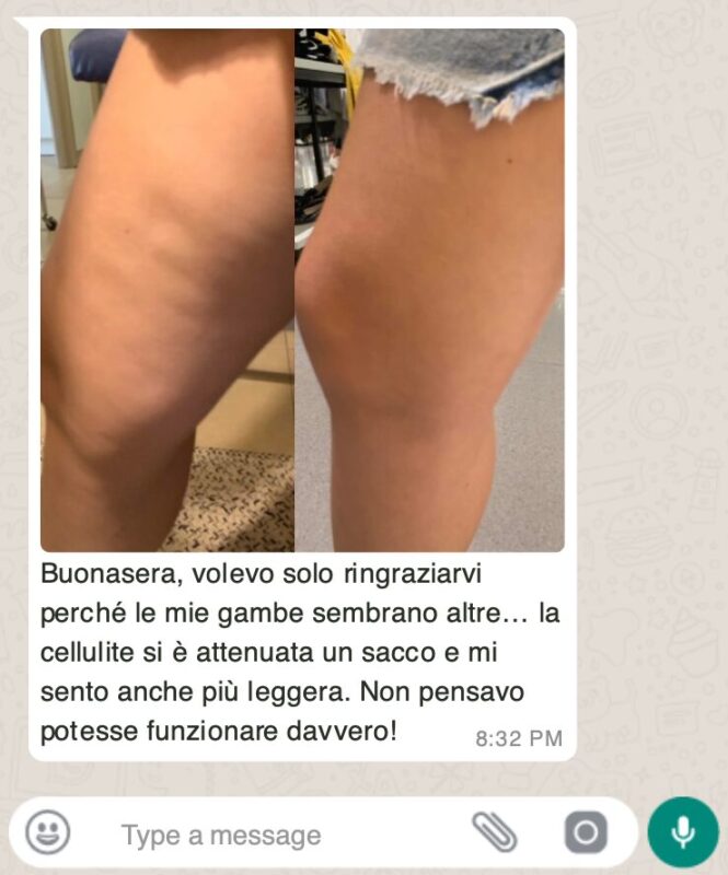 La Betulla: il Rimedio Naturale per Drenare e Depurare il Corpo