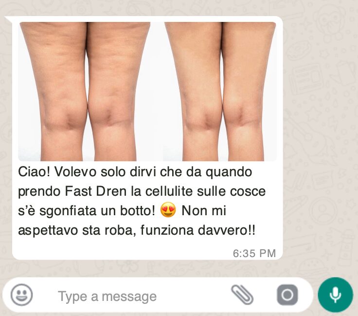 La Betulla: il Rimedio Naturale per Drenare e Depurare il Corpo