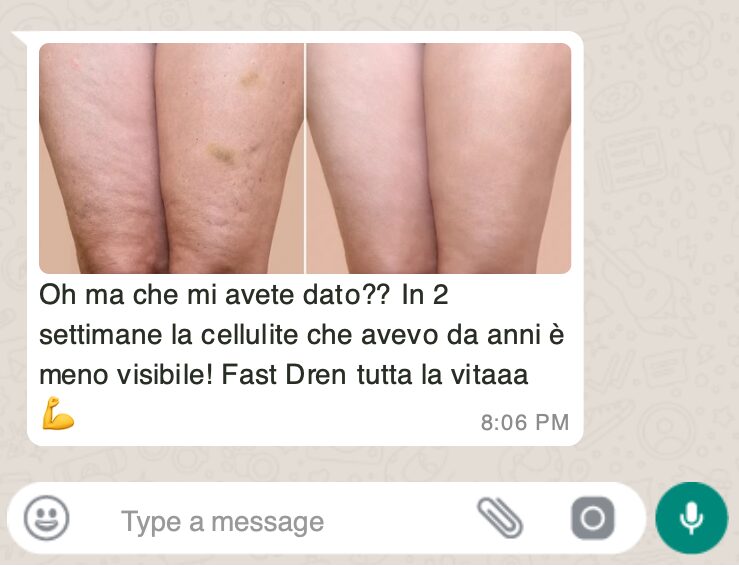 La Betulla: il Rimedio Naturale per Drenare e Depurare il Corpo